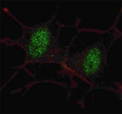 Fluorescent confocal image of SY5Y cells stained with SMAD2 antibody at 1:100. Note the highly specific localization of the SMAD2 to the nucleus.