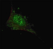 Fluorescent confocal image of SY5Y cells stained with SMAD2 antibody at 1:200. Note the highly specific localization of the SMAD2 to the nucleus.