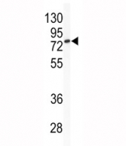 Western blot analysis of BCL6 antibody and mouse cerebellum tissue lysate. Predicted molecular weight: 78~100 kDa.