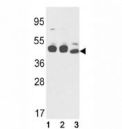 Western blot analysis of Cytokeratin-18 antibody and (1) K562, (2) NCI-H460, and (3) mouse stomach lysate. Predicted molecular weight ~48 kDa.