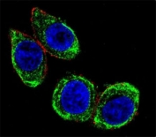 Confocal immunofluorescent analysis of Cytokeratin-18 antibody with HeLa cells followed by Alexa Fluor 488-conjugated goat anti-rabbit lgG (green). Actin filaments have been labeled with Alexa Fluor 555 Phalloidin (red). DAPI was used as a nuclear counterstain (blue).