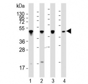 Western blot testing of human 1) NCI-H460, 2) K562, 3) Hela and 4) A431 whole cell lysate with Cytokeratin-18 antibody at 1:2000. Predicted molecular weight ~48 kDa.