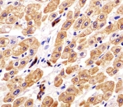 IHC analysis of FFPE human liver tissue with Cytokeratin-18 antibody. Required HIER: steamed antigen retrieval with pH6 citrate buffer.