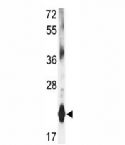 Western blot analysis of DHFR antibody and mouse liver tissue lysate