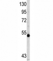 Western blot analysis of MYCN antibody and CEM lysate. Expected/observed molecular weight ~50 kDa.