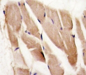 IHC analysis of FFPE human skeletal muscle stained with AMPK alpha 2 antibody