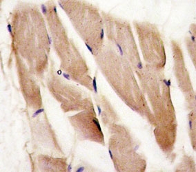 IHC analysis of FFPE human skeletal muscle stained with AMPK alpha 2 an