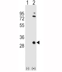 Western blot analysis of APOA1 antibody and 293 cell lysate either nontransfected (Lane 1) or transiently transfected (2) with the APOA1 gene.