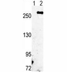 Western blot analysis of FASN antibody and 293 cell lysate either nontransfected (Lane 1) or transiently transfected with the FASN gene (2).
