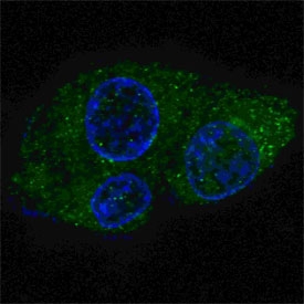 Confocal immunofluorescent analysis of FASN antibody with HepG2 cells followed by Alexa Fluor 488-conjugated goat anti-rabbit lgG (green). DAPI was used as a nuclear counterstain (blue).