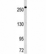 Western blot analysis of FASN antibody in Ramos lysate. Predicted molecular weight ~ 270 kDa.