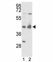 Western blot analysis of IDH antibody and mouse liver tissue and 293 lysate. Predicted molecular weight ~46 kDa.