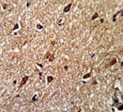 IHC analysis of FFPE human brain stained with IDH antibody