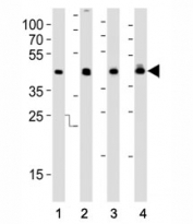 Western blot analysis of lysate from (1) HepG2, (2) MCF-7 cell line, (3) human liver and (4) rat liver tissue using IDH1 antibody at 1:1000. Predicted molecular weight ~46 kDa.