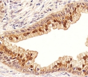 IHC analysis of FFPE human prostate section using IDH1 antibody; Ab was diluted at 1:100.