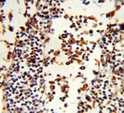 IHC analysis of FFPE human lymph tissue stained with IGHA1 antibody