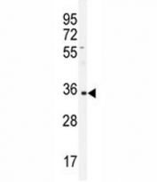 Western blot analysis of IGHA1 antibody and CEM lysate.