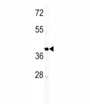 Western blot analysis of IGHM antibody and T47D lysate.
