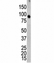 Western blot analysis of ERK4 antibody and mouse brain tissue lysate.