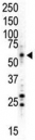 Western blot analysis of MAPK8/ JNK1 antibody and HL-60 (UV-treated) cell lysate.