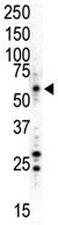 Western blot analysis of MAPK8/ JNK1 antibody and HL-60 (UV-treated) cell lysate.