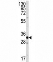 Western blot analysis of CDK2 antibody and Jurkat lysate. Predicted molecular weight ~33 kDa.