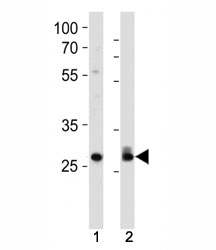 Cdk2 antibody western blot analysis in 293, HeLa lysate. Predicted molecular weight ~33 kDa.~