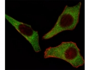 Fluorescent image of HeLa cells stained with CDK4 antibody at 1:25. CDK4 immunoreactivity is localized to the cytoplasm.