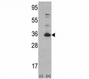 Western blot analysis of CDK4 antibody and 293 cell lysate (2 ug/lane) either nontransfected (Lane 1) or transiently transfected with the CDK4 gene (2).