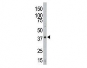 Western blot analysis of CDK4 antibody and HL-60 cell lysate. Predicted molecular weight ~34 kDa.