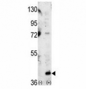Western blot analysis of p38 antibody and 293 cell lysate (2 ug/lane) either nontransfected (Lane 1) or transiently transfected with the MAPK14 gene (2).