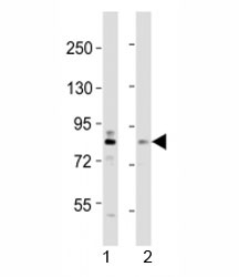 Western blot testing of DYRK1A antibody at 1:2000 dilution. Lane 1: mouse brain lysate; 2: HeLa lysate; Predicted molecular weight ~ 85 kDa.~
