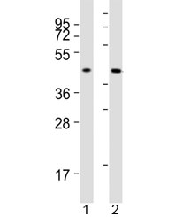Western blot testing of ACAT1 antibody at 1:1000 dilution. Lane 1: human SK-BR-3 lysate; 2: human HepG2 lysate; Predicted molecular weight: ~45 kDa.