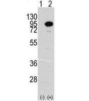 Western blot analysis of ACO2 antibody and 293 cell lysate either nontransfected (Lane 1) or transiently transfected with the ACO2 gene (2). Predicted molecular weight ~85 kDa.
