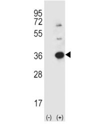 Western blot analysis using anti-Caspase-3 antibody and 293 cell lysate (2 ug/lane) either nontransfected (Lane 1) or transiently transfected (2) with the CASP3 gene.