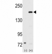 Western blot analysis of SRC-1 antibody and 293 cell lysate (2 ug/lane) either nontransfected (Lane 1) or transiently transfected with the NCOA1 gene (2).