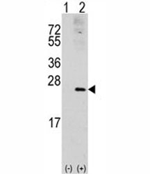 Western blot analysis of RAC1 antibody and 293 cell lysate (2 ug/lane) either nontransfected (Lane 1) or transiently transfected with the RAC1 gene (2).