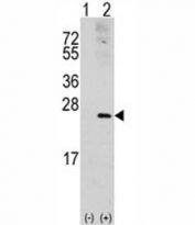 Western blot analysis of RAC1 antibody and 293 cell lysate (2 ug/lane) either nontransfected (Lane 1) or transiently transfected with the RAC1 gene (2).