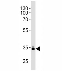 Western blot analysis of lysate from human plasma tissue lysate using ApoE antibody diluted at 1:1000. Predicted molecular weight: 34-37 kDa~