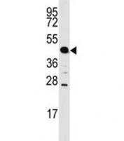 Western blot analysis of ACPP antibody and mouse lung tissue lysate. Expected molecular weight: 45-50 kDa.