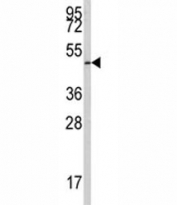 Western blot analysis of E2F1 antibody and 293 lysate. Predicted molecular weight: 48-70 kDa.