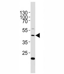 Western blot testing of E2F1 antibody at 1:2000 dilution + HeLa lysate; Predicted molecular weight: 48-60 kDa.