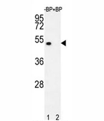 Western blot analysis of E2F1 antibody pre-incubated without (lane 1) and with (2) blocking peptide in 293T lysate. Predicted molecular weight: 48-60 kDa.
