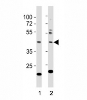 Western blot testing of E2F1 antibody at 1:1000 dilution. Lane 1: NIH3T3 lysate; 2: A431; Predicted molecular weight: 48-60 kDa.