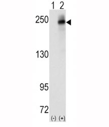 Western blot analysis of ALK antibody and 293 cell lysate (2 ug/lane) either nontransfected (Lane 1) or transiently transfected with the human gene (2). Predicted molecular weight: 190-220 kDa.~