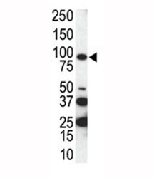 Western blot analysis of AXL antibody and SKBR3 cell lysate. Predicted molecular weight is 104 kDa unglycosylated, 120-140 kDa with glycosylation