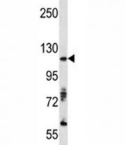 Western blot analysis of AXL antibody and A375 lysate. Predicted molecular weight is 104 kDa unglycosylated, 120-140 kDa with glycosylation