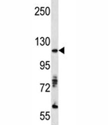 Western blot analysis of AXL antibody and A375 lysate. Predicted molecular weight is 104 kDa unglycosylated, 120-140 kDa with glycosylation