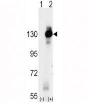 Western blot analysis of CSF1R antibody and 293 cell lysate (2 ug/lane) either nontransfected (Lane 1) or transiently transfected with the CSF1R gene (2).