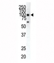 Western blot analysis of EphA1 antibody and HeLa cell lysate.